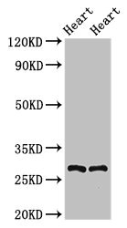 MYF5 / MYF 5 Antibody - Positive Western Blot detected in Rat heart tissue, Mouse heart tissue. All lanes: MYF5 antibody at 2.5 µg/ml Secondary Goat polyclonal to rabbit IgG at 1/50000 dilution. Predicted band size: 29 KDa. Observed band size: 29 KDa
