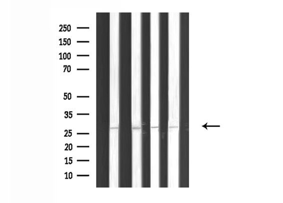 MYF5 / MYF 5 Antibody - Western blot analysis of extracts of various tissue sample using MYF5 antibody.
