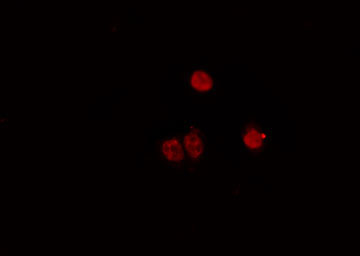 MYF5 / MYF 5 Antibody - Staining HeLa cells by IF/ICC. The samples were fixed with PFA and permeabilized in 0.1% Triton X-100, then blocked in 10% serum for 45 min at 25°C. The primary antibody was diluted at 1:200 and incubated with the sample for 1 hour at 37°C. An Alexa Fluor 594 conjugated goat anti-rabbit IgG (H+L) antibody, diluted at 1/600, was used as secondary antibody.