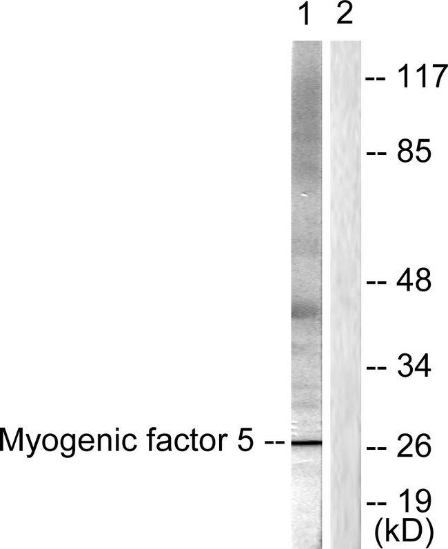 MYF5 / MYF 5 Antibody - Western blot analysis of extracts from HepG2 cells, using MYF5 (Ab-49) antibody.