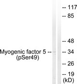 MYF5 / MYF 5 Antibody - Western blot analysis of lysates from HeLa cells, using Myogenic Factor 5 (Phospho-Ser49) Antibody. The lane on the right is blocked with the phospho peptide.