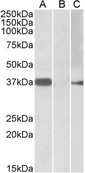 MYF6 / MRF4 Antibody - HEK293 lysate (10ug protein in RIPA buffer) overexpressing Human MYF6 with MYC tag probed with (0.5ug/ml) in Lane A and probed with anti-MYC Tag (1/1000) in lane C. Mock-transfected HEK293 probed (0.5mg/ml) in Lane B. Primary incubati