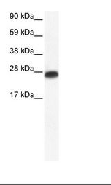 MYF6 / MRF4 Antibody - Fetal Heart Lysate.  This image was taken for the unconjugated form of this product. Other forms have not been tested.