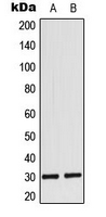 MYF6 / MRF4 Antibody - Western blot analysis of MYF6 expression in MCF7 (A); rat heart (B) whole cell lysates.