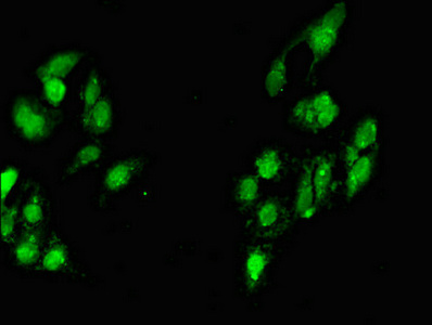 MYF6 / MRF4 Antibody - Immunofluorescent analysis of Hela cells diluted at 1:100 and Alexa Fluor 488-congugated AffiniPure Goat Anti-Rabbit IgG(H+L)