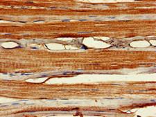 MYF6 / MRF4 Antibody - Immunohistochemistry of paraffin-embedded human skeletal muscle tissue at dilution of 1:100
