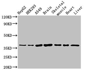 MYF6 / MRF4 Antibody - Western Blot Positive WB detected in:HepG2 whole cell lysate,HEK293 whole cell lysate,A549 whole cell lysate,Mouse brain tissue,Mouse skeletal muscle,Rat heart tissue,Rat liver tissue All Lanes:MYF6 antibody at 3µg/ml Secondary Goat polyclonal to rabbit IgG at 1/50000 dilution Predicted band size: 27 KDa Observed band size: 37 KDa
