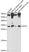 MYF6 / MRF4 Antibody - Western blot analysis of extracts of various cell lines, using MYF6 antibody at 1:1000 dilution. The secondary antibody used was an HRP Goat Anti-Rabbit IgG (H+L) at 1:10000 dilution. Lysates were loaded 25ug per lane and 3% nonfat dry milk in TBST was used for blocking. An ECL Kit was used for detection and the exposure time was 5s.