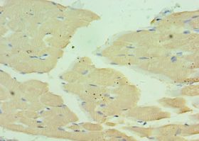 MYH1 Antibody - Immunohistochemistry of paraffin-embedded human skeletal muscle using antibody at 1:100 dilution.