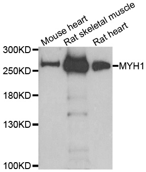 MYH1 Antibody - Western blot analysis of extracts of various cell lines.