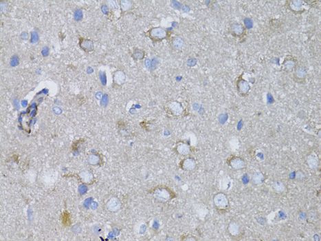 MYH10 Antibody - Immunohistochemistry of paraffin-embedded rat brain using MYH10 antibody at dilution of 1:100 (40x lens).