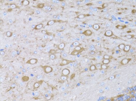 MYH10 Antibody - Immunohistochemistry of paraffin-embedded mouse brain using MYH10 antibody at dilution of 1:100 (40x lens).