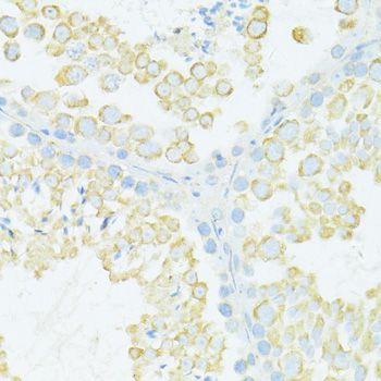 MYH10 Antibody - Immunohistochemistry of paraffin-embedded mouse testis using MYH10 antibody at dilution of 1:100 (40x lens).