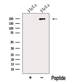 MYH10 Antibody - Western blot analysis of extracts of HeLa cells using MYH10-Specific antibody. The lane on the left was treated with blocking peptide.