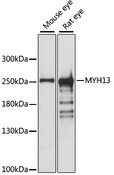 MYH13 Antibody - Western blot analysis of extracts of various cell lines, using MYH13 antibody at 1:1000 dilution. The secondary antibody used was an HRP Goat Anti-Rabbit IgG (H+L) at 1:10000 dilution. Lysates were loaded 25ug per lane and 3% nonfat dry milk in TBST was used for blocking. An ECL Kit was used for detection and the exposure time was 10s.