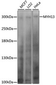MYH13 Antibody - Western blot analysis of extracts of various cell lines, using MYH13 antibody at 1:1000 dilution. The secondary antibody used was an HRP Goat Anti-Rabbit IgG (H+L) at 1:10000 dilution. Lysates were loaded 25ug per lane and 3% nonfat dry milk in TBST was used for blocking. An ECL Kit was used for detection and the exposure time was 20s.