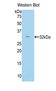 MYH14 Antibody - Western blot of recombinant MYH14.  This image was taken for the unconjugated form of this product. Other forms have not been tested.