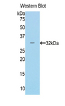 MYH14 Antibody - Western blot of recombinant MYH14.  This image was taken for the unconjugated form of this product. Other forms have not been tested.