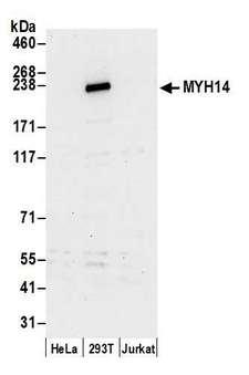 MYH14 Antibody - Detection of human MYH14 by western blot. Samples: Whole cell lysate (15 µg) from HeLa, HEK293T, and Jurkat cells prepared using NETN lysis buffer. Antibody: Affinity purified rabbit anti-MYH14 antibody used for WB at 0.1 µg/ml. Detection: Chemiluminescence with an exposure time of 30 seconds.