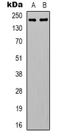 MYH14 Antibody - Western blot analysis of Myosin 14 expression in HeLa (A); A431 (B) whole cell lysates.