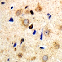 MYH14 Antibody - Immunohistochemical analysis of Myosin 14 staining in human brain formalin fixed paraffin embedded tissue section. The section was pre-treated using heat mediated antigen retrieval with sodium citrate buffer (pH 6.0). The section was then incubated with the antibody at room temperature and detected with HRP and DAB as chromogen. The section was then counterstained with hematoxylin and mounted with DPX.