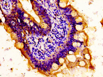 MYH14 Antibody - Immunohistochemistry image at a dilution of 1:100 and staining in paraffin-embedded human small intestine tissue performed on a Leica BondTM system. After dewaxing and hydration, antigen retrieval was mediated by high pressure in a citrate buffer (pH 6.0) . Section was blocked with 10% normal goat serum 30min at RT. Then primary antibody (1% BSA) was incubated at 4 °C overnight. The primary is detected by a biotinylated secondary antibody and visualized using an HRP conjugated ABC system.