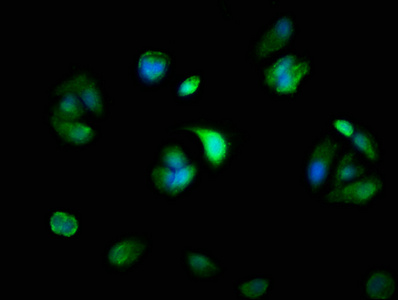 MYH14 Antibody - Immunofluorescence staining of MCF-7 cells with MYH14 Antibody at 1:100, counter-stained with DAPI. The cells were fixed in 4% formaldehyde, permeabilized using 0.2% Triton X-100 and blocked in 10% normal Goat Serum. The cells were then incubated with the antibody overnight at 4°C. The secondary antibody was Alexa Fluor 488-congugated AffiniPure Goat Anti-Rabbit IgG(H+L).