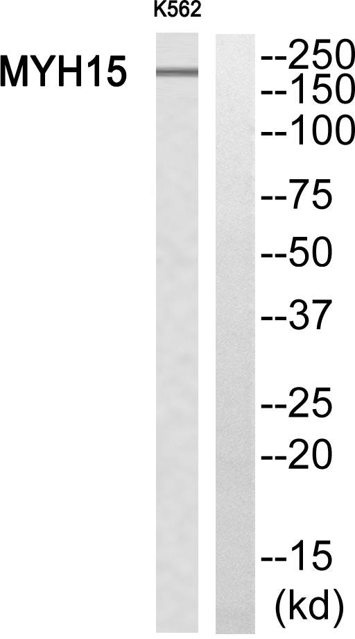 MYH15 Antibody - Western blot analysis of extracts from K562 cells, using MYH15 antibody.