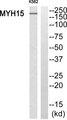 MYH15 Antibody - Western blot analysis of extracts from K562 cells, using MYH15 antibody.