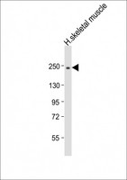 MYH2 Antibody - Anti-MYH2 Antibody (N-Term) at 1:2000 dilution + human skeletal muscle lysate Lysates/proteins at 20 ug per lane. Secondary Goat Anti-Rabbit IgG, (H+L), Peroxidase conjugated at 1:10000 dilution. Predicted band size: 223 kDa. Blocking/Dilution buffer: 5% NFDM/TBST.