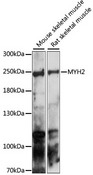 MYH2 Antibody - Western blot analysis of extracts of various cell lines, using MYH2 antibody at 1:1000 dilution. The secondary antibody used was an HRP Goat Anti-Rabbit IgG (H+L) at 1:10000 dilution. Lysates were loaded 25ug per lane and 3% nonfat dry milk in TBST was used for blocking. An ECL Kit was used for detection and the exposure time was 180s.