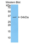 MYH3 Antibody - Western blot of recombinant MYH3.  This image was taken for the unconjugated form of this product. Other forms have not been tested.