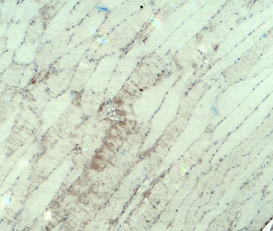 MYH3 Antibody - Immunohistochemistry of MYH3 in mouse skeletal muscle tissue with MYH3 antibody at 5 ug/ml.
