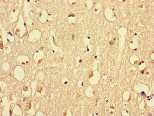 MYH3 Antibody - Immunohistochemistry of paraffin-embedded human brain tissue at dilution of 1:100