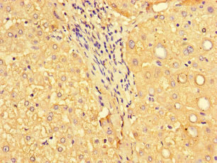 MYH3 Antibody - Immunohistochemistry of paraffin-embedded human liver tissue at dilution of 1:100