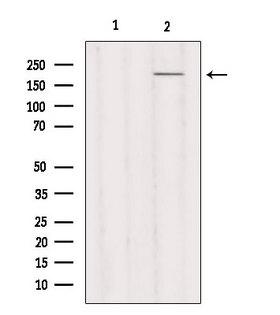 MYH3 Antibody - Western blot analysis of extracts of HeLa cells using MYH3 antibody. Lane 1 was treated with the blocking peptide.