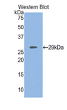 MYH4 Antibody - Western blot of recombinant MYH4.  This image was taken for the unconjugated form of this product. Other forms have not been tested.