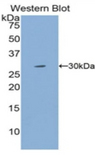 MYH4 Antibody - Western blot of recombinant MYH4.  This image was taken for the unconjugated form of this product. Other forms have not been tested.