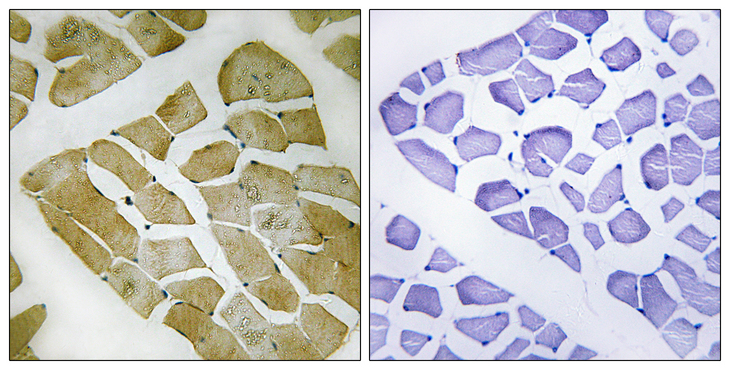 MYH4 Antibody - Immunohistochemistry analysis of paraffin-embedded human skeletal muscle, using MYH4 Antibody. The picture on the right is blocked with the synthesized peptide.