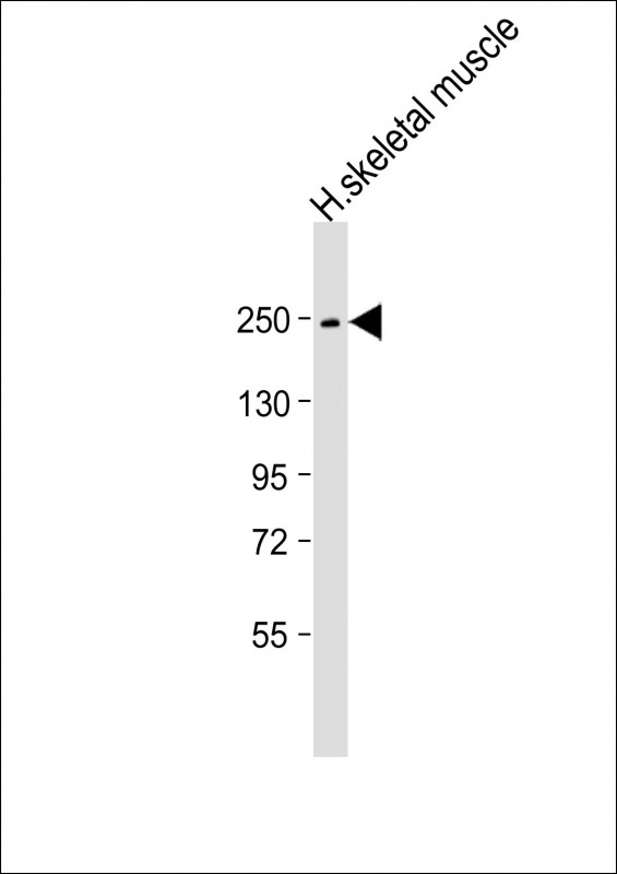 MYH4 Antibody - Anti-MYH4 Antibody (N-Term) at 1:1000 dilution + human skeletal muscle lysate Lysates/proteins at 20 ug per lane. Secondary Goat Anti-Rabbit IgG, (H+L), Peroxidase conjugated at 1:10000 dilution. Predicted band size: 223 kDa. Blocking/Dilution buffer: 5% NFDM/TBST.