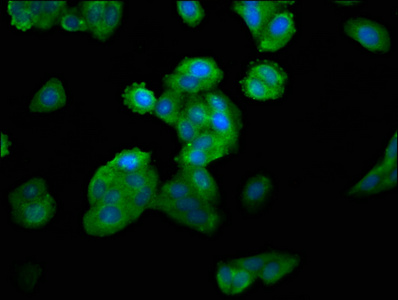 MYH4 Antibody - Immunofluorescence staining of HepG2 cells at a dilution of 1:100, counter-stained with DAPI. The cells were fixed in 4% formaldehyde, permeabilized using 0.2% Triton X-100 and blocked in 10% normal Goat Serum. The cells were then incubated with the antibody overnight at 4 °C.The secondary antibody was Alexa Fluor 488-congugated AffiniPure Goat Anti-Rabbit IgG (H+L) .