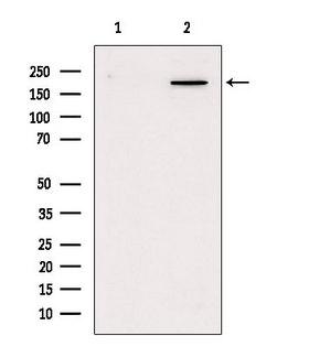 MYH4 Antibody - Western blot analysis of extracts of mouse lung using MYH4-Specific antibody. Lane 1 was treated with the blocking peptide.