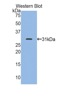 MYH7 Antibody - Western blot of recombinant MYH7.  This image was taken for the unconjugated form of this product. Other forms have not been tested.