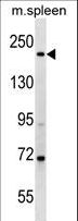 MYH7 Antibody - MYH7 Antibody western blot of mouse spleen tissue lysates (35 ug/lane). The MYH7 antibody detected the MYH7 protein (arrow).