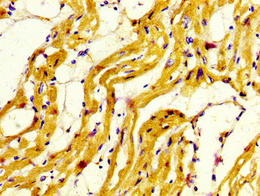 MYH7 Antibody - Immunohistochemistry image at a dilution of 1:800 and staining in paraffin-embedded human heart tissue performed on a Leica BondTM system. After dewaxing and hydration, antigen retrieval was mediated by high pressure in a citrate buffer (pH 6.0) . Section was blocked with 10% normal goat serum 30min at RT. Then primary antibody (1% BSA) was incubated at 4 °C overnight. The primary is detected by a biotinylated secondary antibody and visualized using an HRP conjugated SP system.