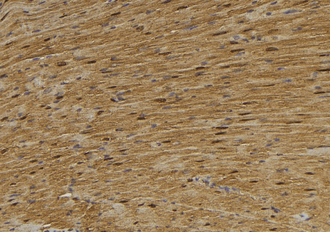 MYH7 Antibody - 1:100 staining mouse muscle tissue by IHC-P. The sample was formaldehyde fixed and a heat mediated antigen retrieval step in citrate buffer was performed. The sample was then blocked and incubated with the antibody for 1.5 hours at 22°C. An HRP conjugated goat anti-rabbit antibody was used as the secondary.