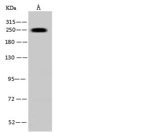 MYH7 Antibody - Anti-MYH7 rabbit polyclonal antibody at 1:500 dilution. Lane A: U-251 MG Whole Cell Lysate. Lysates/proteins at 30 ug per lane. Secondary: Goat Anti-Rabbit IgG (H+L)/HRP at 1/10000 dilution. Developed using the ECL technique. Performed under reducing conditions. Predicted band size: 223 kDa. Observed band size: 250 kDa.