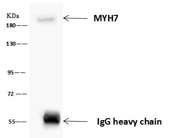 MYH7 Antibody - MYH7 was immunoprecipitated using: Lane A: 0.5 mg Rat skeletal muscle Whole Cell Lysate. 4 uL anti-MYH7 rabbit polyclonal antibody and 60 ug of Immunomagnetic beads Protein A/G. Primary antibody: Anti-MYH7 rabbit polyclonal antibody, at 1:100 dilution. Secondary antibody: Goat Anti-Rabbit IgG (H+L)/HRP at 1/10000 dilution. Developed using the ECL technique. Performed under reducing conditions. Predicted band size: 223 kDa. Observed band size: 223 kDa.