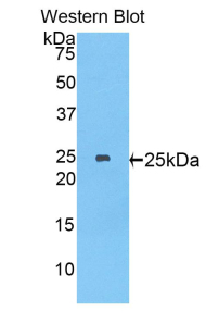 MYH8 Antibody - Western blot of recombinant MYH8.  This image was taken for the unconjugated form of this product. Other forms have not been tested.