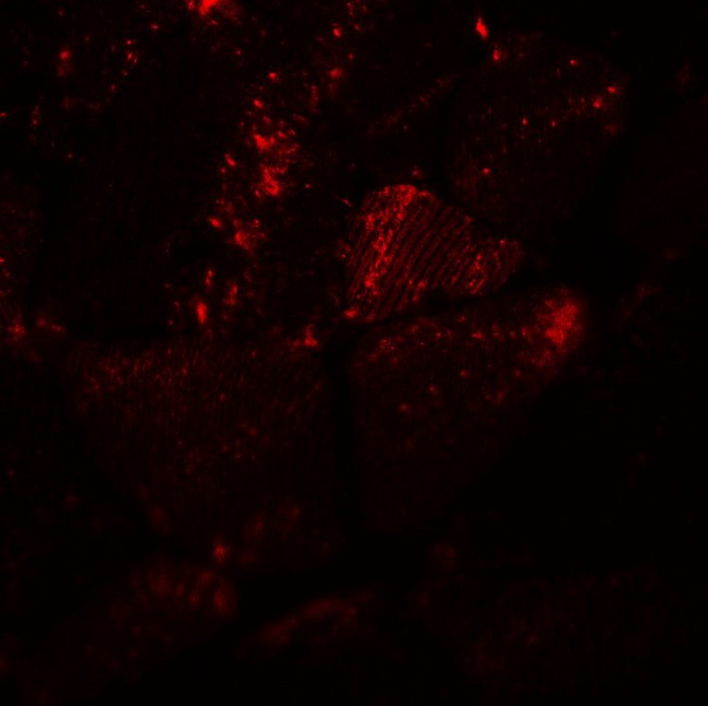 MYH8 Antibody - Immunofluorescence of MYH8 in mouse skeletal muscle tissue with MYH8 antibody at 20 ug/ml.